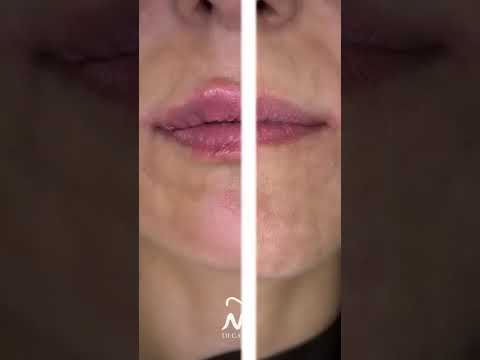 Maria Patrizia Di Caprio-31
