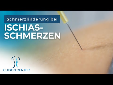 Ischiasschmerzen was kannst Du tun?