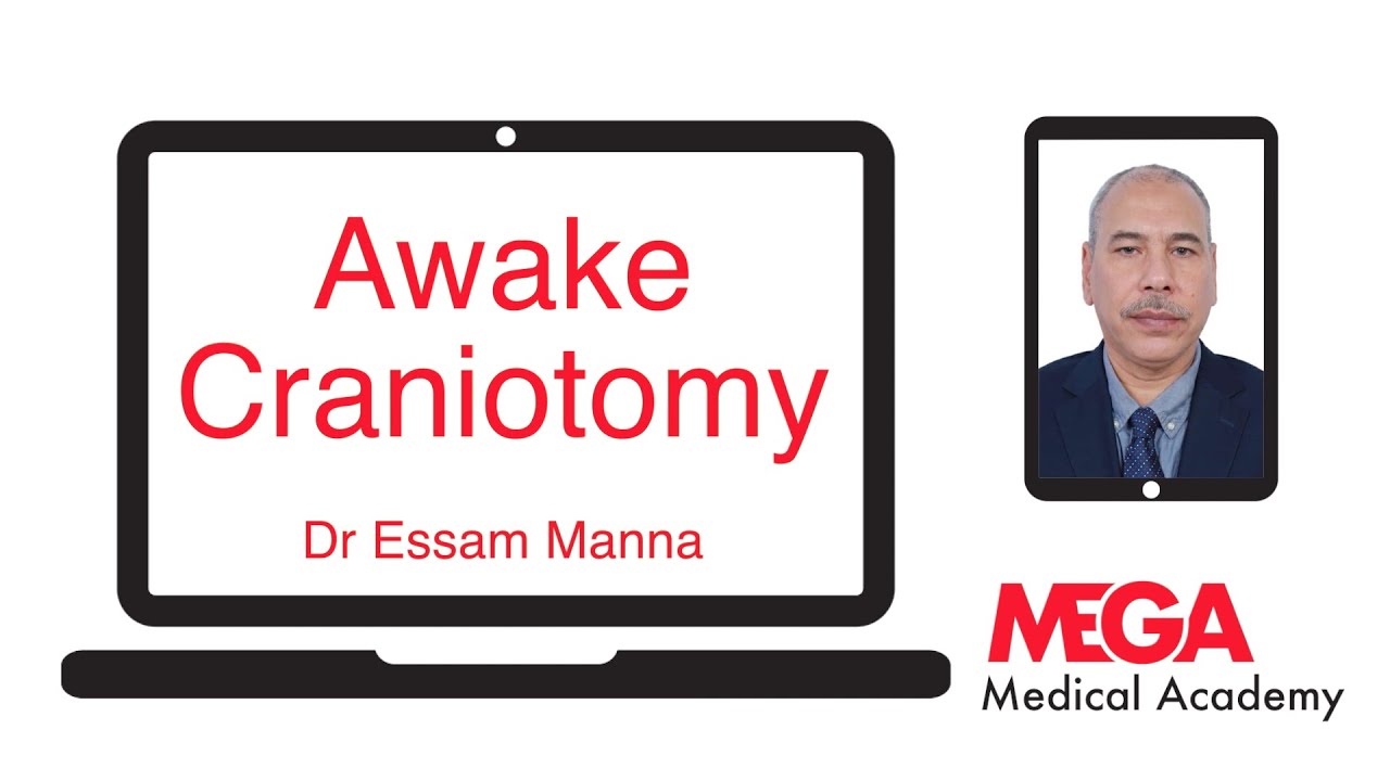 Awake Craniotomy