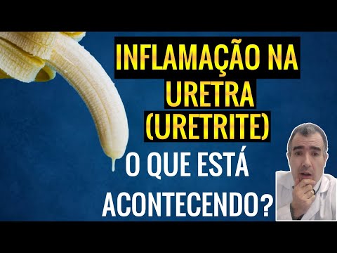 , title : 'Inflamação da uretra - as causas desse problema'