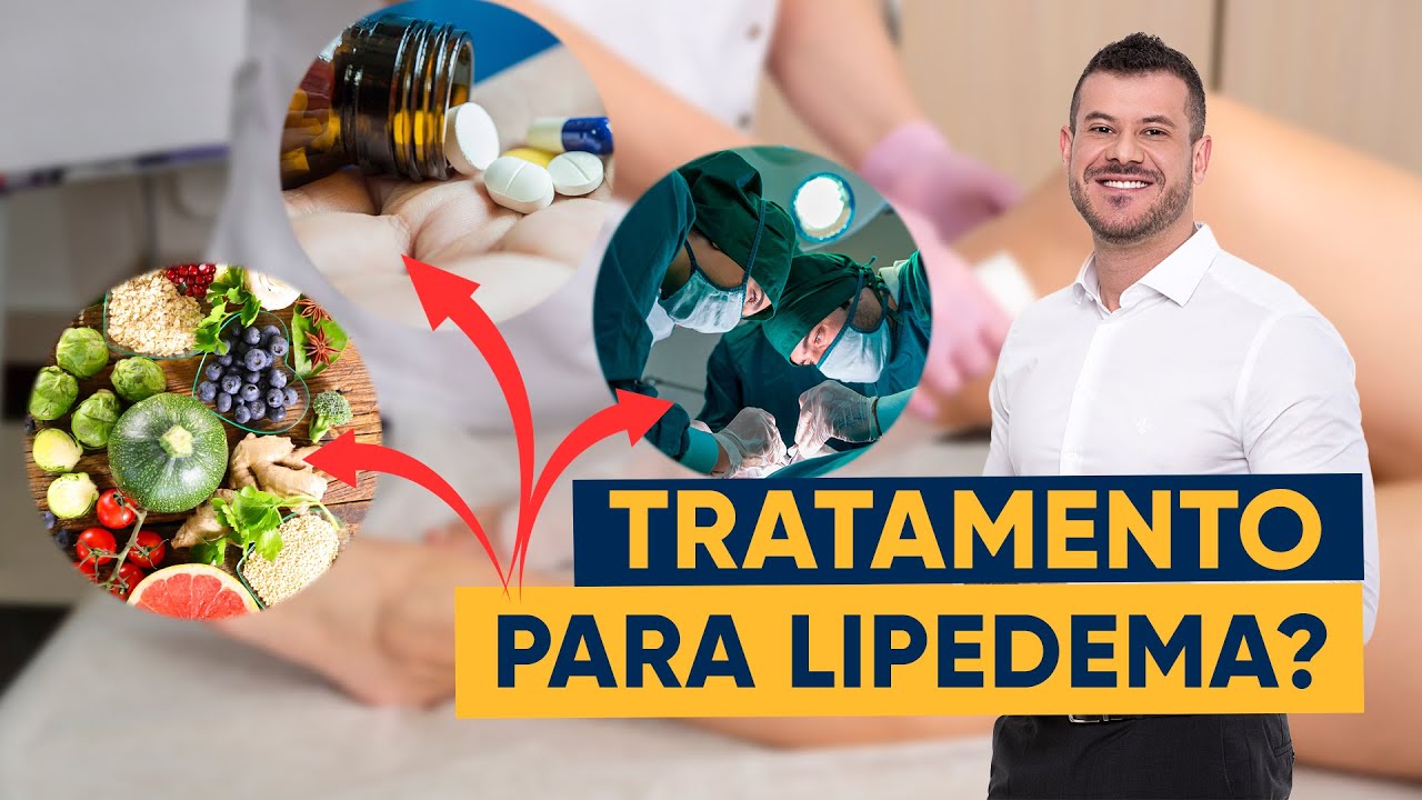 TRATAMENTO DO LIPEDEMA - entenda Como Tratar Lipedema | Dr. Felipe Balem