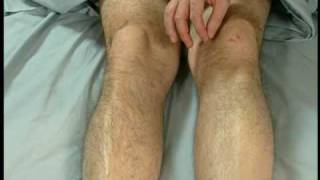 Stroke Scale Certification - Group A - Patient 1