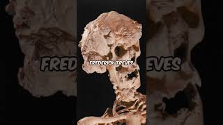 Scary Secrets of Joseph Merrick: The Tragic Tale of The Elephant Man Revealed! 😱 #shorts