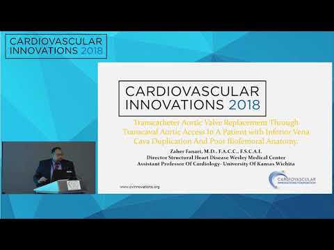 CVI2018 Session: Structural Challenging Case Competition: Semifinals 1 (July 27, 13:30 pm)