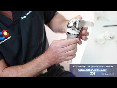 Modern Total Knee Replacement   Design and Technique