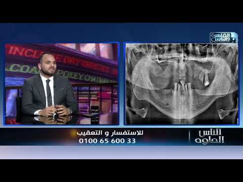 مقابلة — زراعة الفك بالكامل
