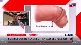 Todo lo que debes saber acerca de la Cirugía de Frenillo Corto del pene