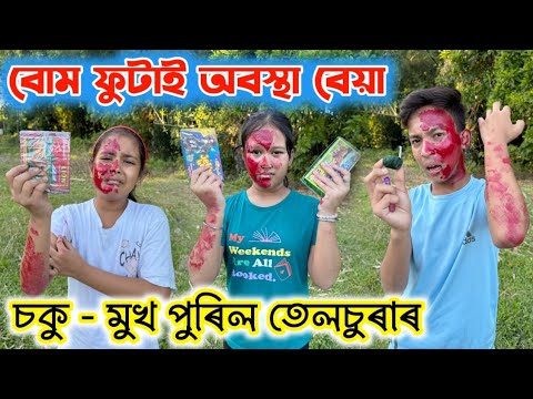 তেলচুৰাৰ মুখ পুৰিল ।। Telsura Comedy Video || Assamese Funny Video || Voice Assam || 