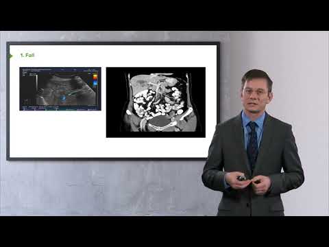 Innere Medizin I Gastroenterologie - Fallbeispiel 1: Leber- & Pancreaserkrankungen I PD Dr. M. Hocke