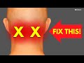 How To Instantly Relieve Neck Pain At The BASE OF THE SKULL