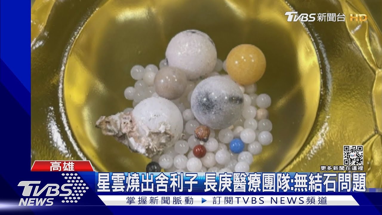 星雲燒出舍利子 高長庚醫療醫師:大師沒有結石問題