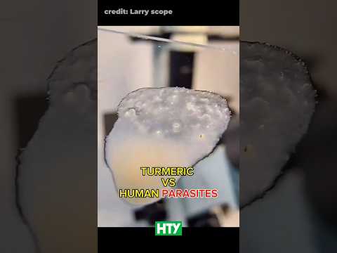 Turmeric vs. Parasitic Worms - You Won’t Believe This 🫚🔬