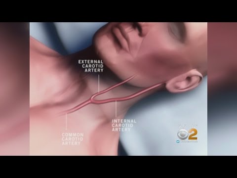 Dr. Max Gomez: Dangerous Hickeys