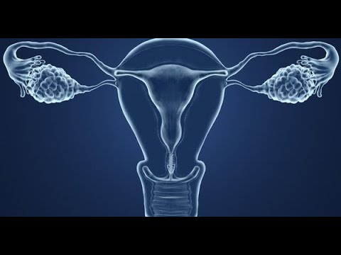 comment guerir de la dystrophie ovarienne