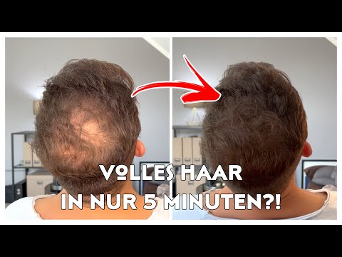 VOLLES HAAR IN NUR 5 MINUTEN?! - Schütthaar als Alternative zur Haartransplantation?