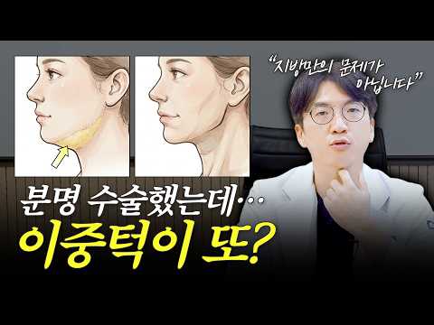 이중턱 재수술 원인? 생각보다 볼 게 많더라고요!
