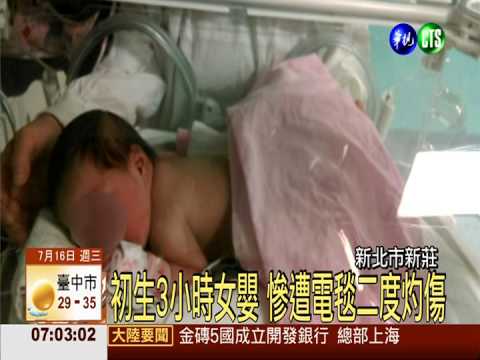 標示禁用竟不理 診所電毯灼傷嬰