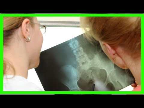 La neuropatia del rachide cervicale Come aiutare con il mal di schiena in gravidanza