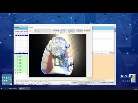 Hyper-Dent Abrechnungssoftware im Dentallabor