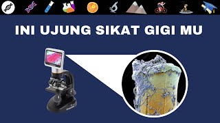Download lagu ZOOM MIKROSKOP...KUMAN DI SIKAT GIGI - DIRGA BIOLOGY CHANNEL mp3 Download lagu ZOOM MIKROSKOP...KUMAN DI SIKAT GIGI - DIRGA BIOLOGY CHANNEL mp3