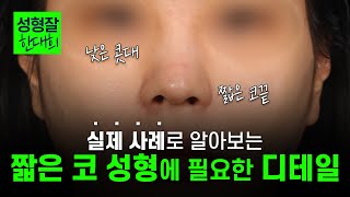 얼굴 비율이 좋아지는 코를 만드는 에디션의 코 성형 디테일 | 낮고 짧은 코 성형
