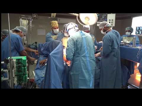 3D Printing: Guided Precise Surgery For Complex Pulmonary AV Malformation