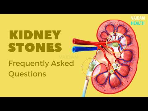 Kidney Stones- Frequently Asked Questions