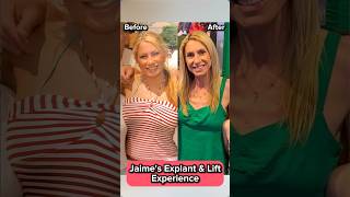 Lampert Md Plastic Surgery