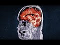 A Bodybuilder Mistook An Aphrodisiac for Pre-Workout Supplement. This Is What Happened To His Brain.