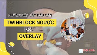 Orthodontic Practice: Guide to Taking Bite Impressions for Twin Block and Overlay Appliances