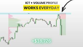 ICT + Volume Profile = Insane Profit