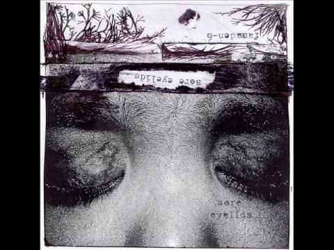 Sore Eyelids - Last time