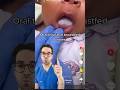 What Is Oral Thrush & How To Treat It | Dr. Yoshi Explains Baby Mouth Infections