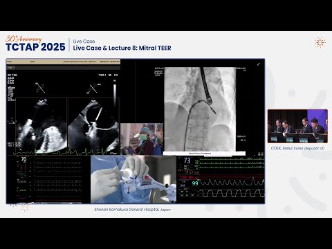 [TCTAP 2025] Live Case & Lecture 8: Mitral TEER