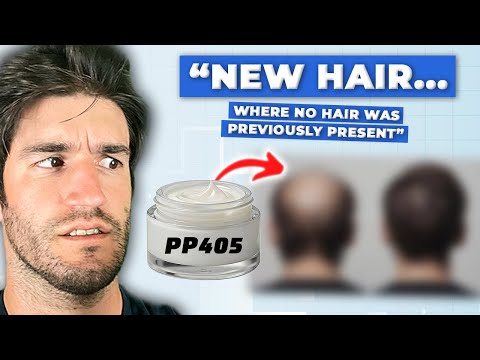 PP405: Regrows Hair In 8 Weeks. Is This The Miracle Cure?