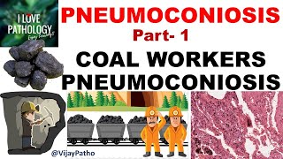 PNEUMOCONIOSIS Part 1: Pathogenesis, Coal workers pneumoconiosis