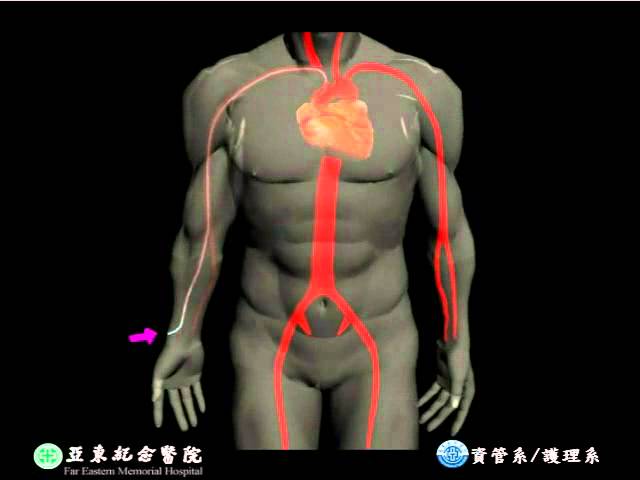 心導管檢查與治療