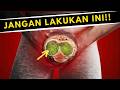 JANGAN LAKUKAN INI PADA MR P KAMU Podcast Kesehatan