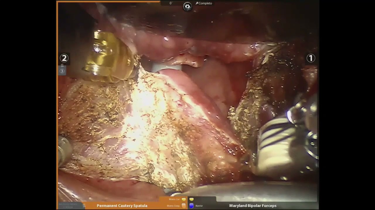 Adriano Santana Fonseca-15