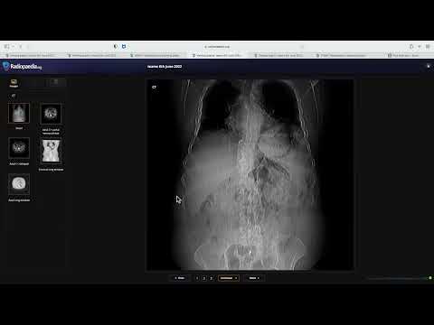 TEAM FRCR 2B-Dr Aprajita Mehta (Viva Practice Session). 6th June, 2022