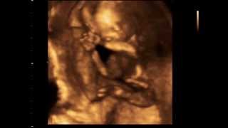 4 BOYUT USG İLE 16 HAFTALIK BEBEK VİDEOSU
