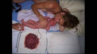 Nascita con la Placenta - LOTUS BIRTH: Cosa ne pensa il dottor MICHEL ODENT? (con audio)