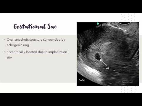 Ultrasound in OB (Obstetrics) and Pregnancy Basics