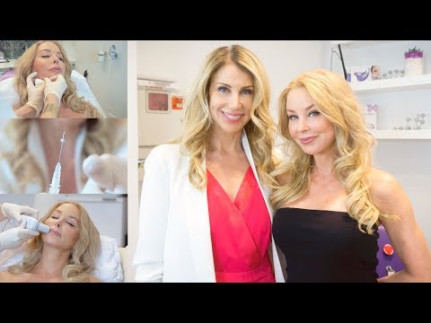Nurse Jamie Visit: Skin Tightening & Toning Over 40 with Sugar Threads and Ultherapy