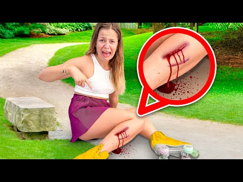 NINNA FELL OFF HER ROLLER SKATES AT THE PARK AND HURTED HER KNEE! 🤕