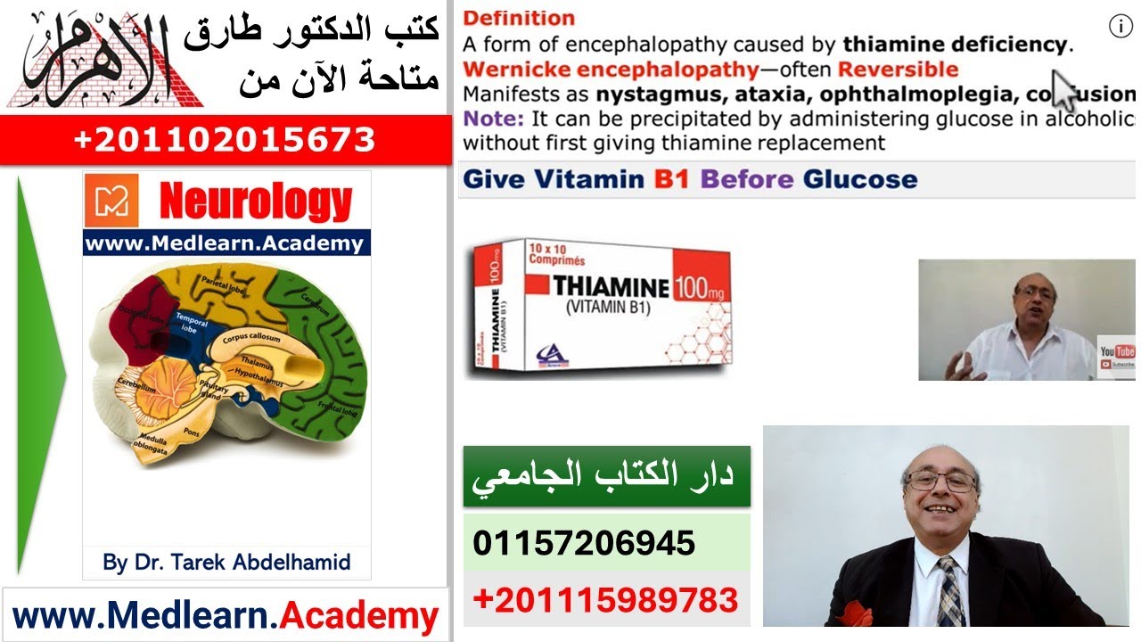 Werneck's encephalopathy #cme #internal_medicine #medicalcollege #usmle #محاضرات_باطنة