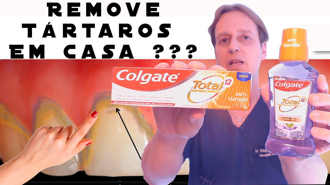O Colgate Total 12 Anti-Tártaro Consegue Tirar Tártaros dos Dentes em Casa? - Resenha