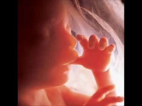 Abortion legal murder millions in USA Jesus will judge this nation Video