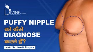 Puffy Nipple को कैसे Diagnose करते हैं?