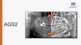 We are proud to announce our latest i-Dixel software innovation: AGS2 (Adaptive Grayscale 2).
Learn more about AGS2 at https://www.morita.com